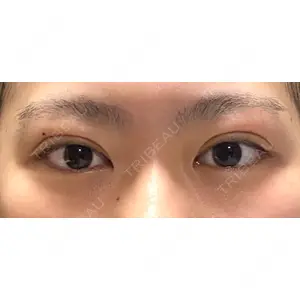 湘南美容クリニック 湘南美容クリニック 池袋東口院口コミ