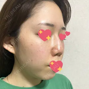 表参道スキンクリニック 表参道スキンクリニック 名古屋院（DAILY SKIN CLINIC提携院）口コミ