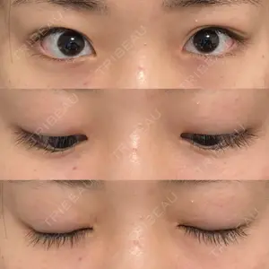 R.O.clinic口コミ