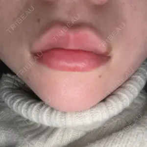 ルラ美容クリニック ルラ美容クリニック 高田馬場院口コミ