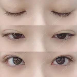 口コミ