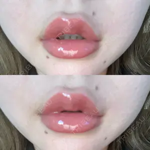 ルラ美容クリニック ルラ美容クリニック 高田馬場院口コミ