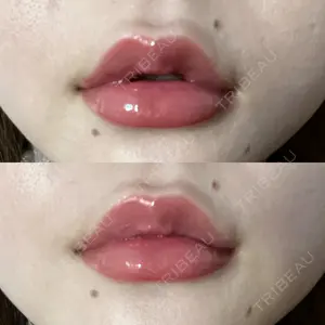 ルラ美容クリニック ルラ美容クリニック 高田馬場院口コミ