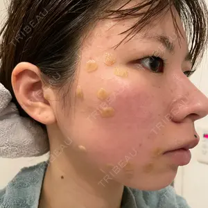 Jスキンクリニック 【J-SKIN clinic】口コミ