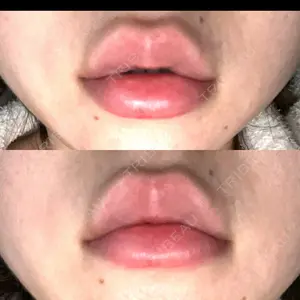 ルラ美容クリニック ルラ美容クリニック 高田馬場院口コミ