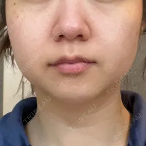 湘南美容クリニック 湘南美容クリニック 宇都宮院口コミ