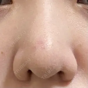 リッツ美容外科 大阪院口コミ