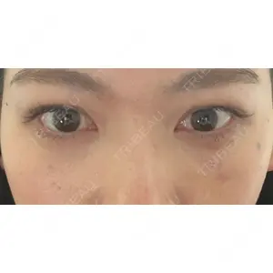 東京イセアクリニック口コミ