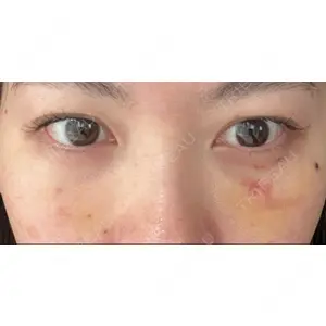 東京イセアクリニック口コミ