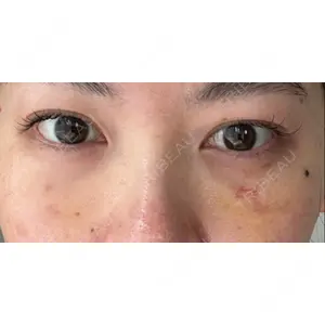 東京イセアクリニック口コミ