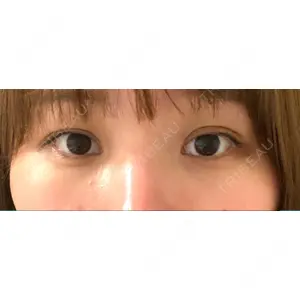 APOLLO BEAUTY CLINIC口コミ