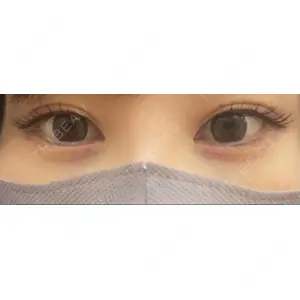 APOLLO BEAUTY CLINIC口コミ