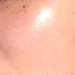 南青山TOKUNAKAクリニック口コミ