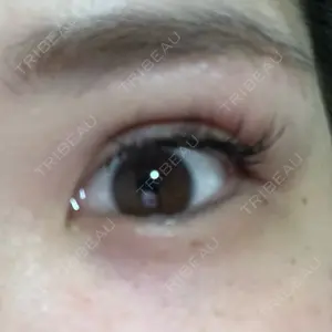 TCB東京中央美容外科 TCB東京中央美容外科 町田院口コミ