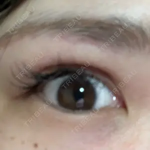 TCB東京中央美容外科 TCB東京中央美容外科 町田院口コミ