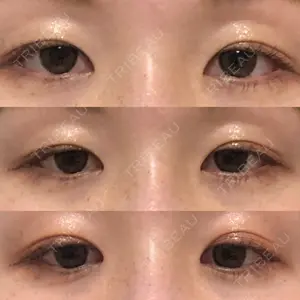 口コミ