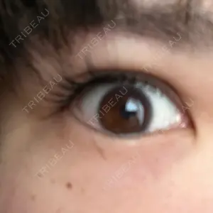 TCB東京中央美容外科 TCB東京中央美容外科 町田院口コミ