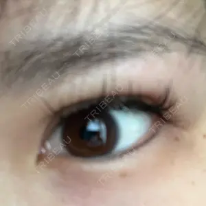 TCB東京中央美容外科 TCB東京中央美容外科 町田院口コミ