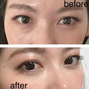 東京イセアクリニック口コミ