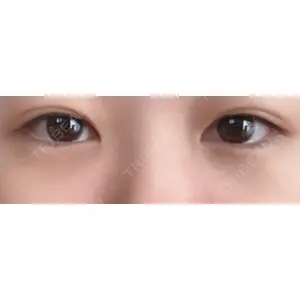 APOLLO BEAUTY CLINIC口コミ