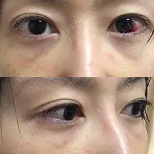 APOLLO BEAUTY CLINIC口コミ