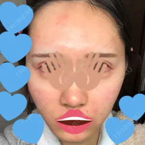 Rinato Beauty Clinic口コミ