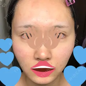 Rinato Beauty Clinic口コミ