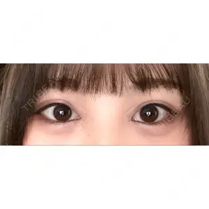 口コミ