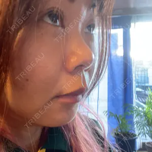 聖心美容クリニック グループ 聖心美容クリニック 六本木院口コミ