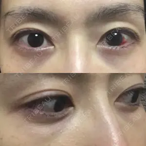 APOLLO BEAUTY CLINIC口コミ