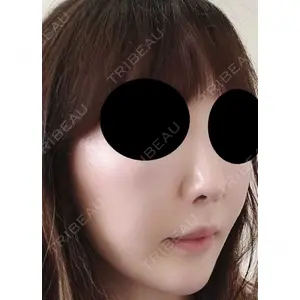 口コミ