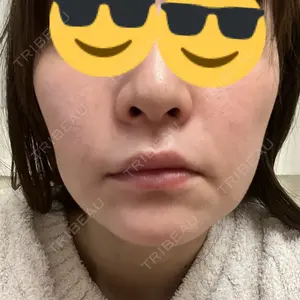 EMMO FACE CLINIC EMMO FACE CLINIC 大宮院口コミ