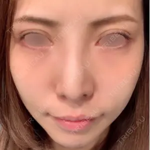VENUS BEAUTY CLINIC　銀座院口コミ