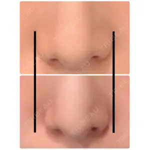 VENUS BEAUTY CLINIC　銀座院口コミ