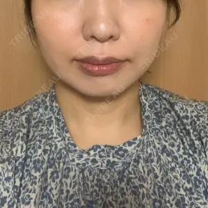 湘南美容クリニック 湘南美容クリニック 秋葉原院口コミ