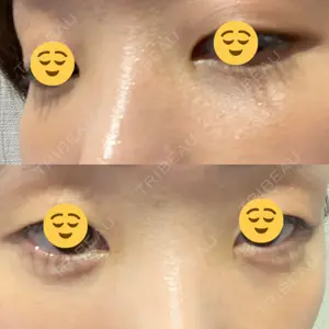 APOLLO BEAUTY CLINIC口コミ