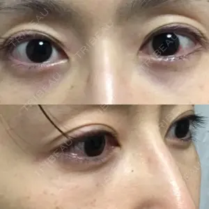 APOLLO BEAUTY CLINIC口コミ