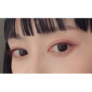 APOLLO BEAUTY CLINIC口コミ