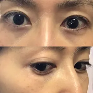 APOLLO BEAUTY CLINIC口コミ