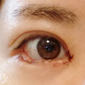 B-LINE CLINIC B-LINE CLINIC 池袋院口コミ