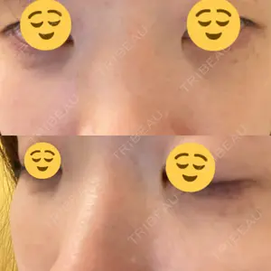 APOLLO BEAUTY CLINIC口コミ