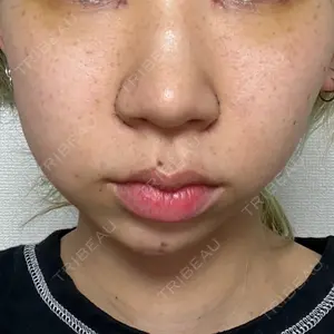 口コミ