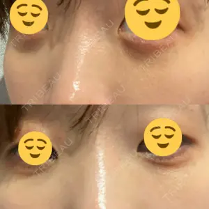 APOLLO BEAUTY CLINIC口コミ