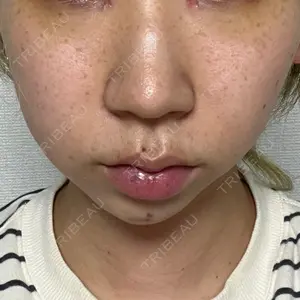 口コミ