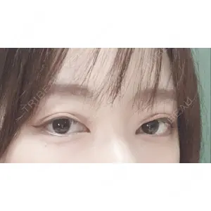 APOLLO BEAUTY CLINIC口コミ