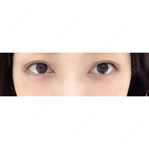 APOLLO BEAUTY CLINIC口コミ