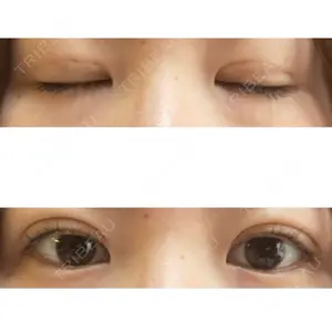 東京BELLEZZAクリニック口コミ