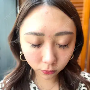 レディアス美容クリニック恵比寿口コミ