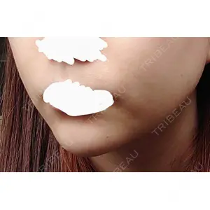 東京皮膚科・形成外科 東京皮膚科・形成外科 (銀座いけだクリニック)口コミ