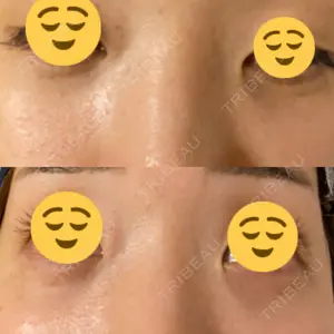 APOLLO BEAUTY CLINIC口コミ